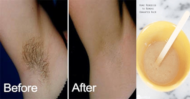 Removing Underarm Hairs In Just 2 Minutes Non Stop Healthy