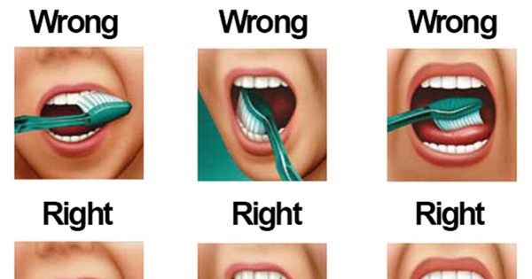 The Top 10 Worst Teeth Brushing Mistakes That Make Our Teeth Decay And 